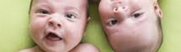 Doublement des naissances de jumeaux dans les pays développés