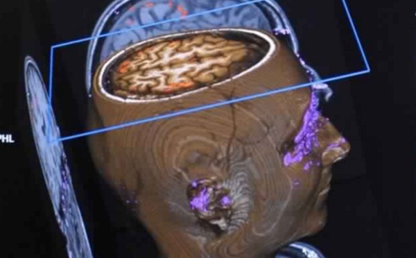 ​Avoir un gros cerveau ne serait pas une bonne nouvelle