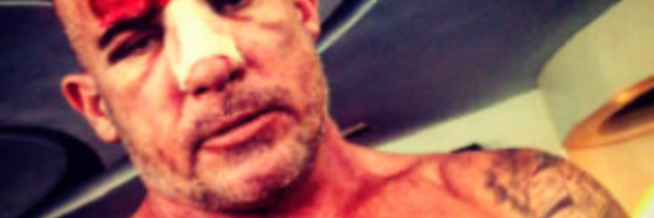 Dominic Purcell sévèrement  blessé sur le tournage de Prison Break au Maroc 