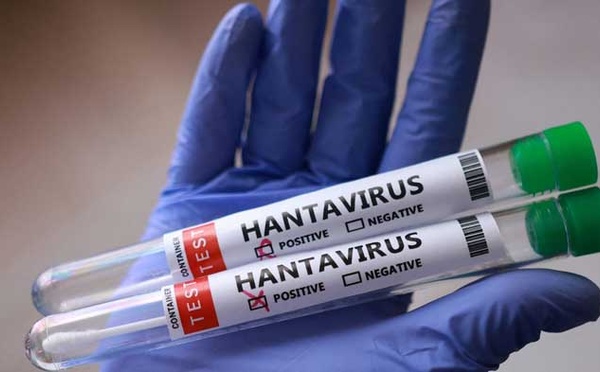 Hantavirus. Faire preuve de vigilance, ne pas céder à la psychose