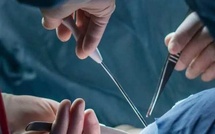 Transféré de Dakhla dans un état critique : Un nouveau-né sauvé par une intervention chirurgicale spécialisée Transféré de Dakhla dans un état critique : Un nouveau-né sauvé par une intervention chirurgicale spécialisée